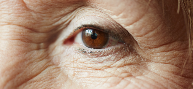 image 10 Cara Menghilangkan Keriput di Wajah Agar Terlihat Muda