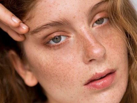 image 3 Cara Menghilangkan Bintik-Bintik di Wajah yang Efektif