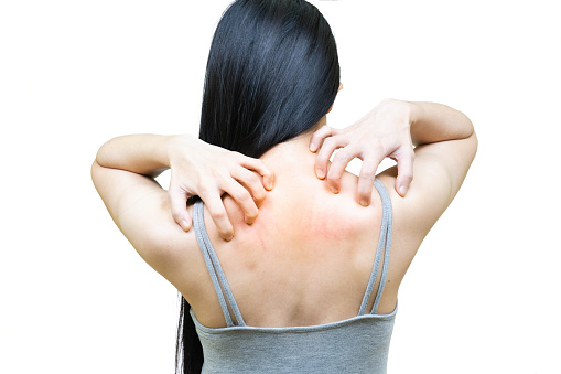 image 3 Penyebab Bintik Merah Pada Kulit, Wajib Tahu!