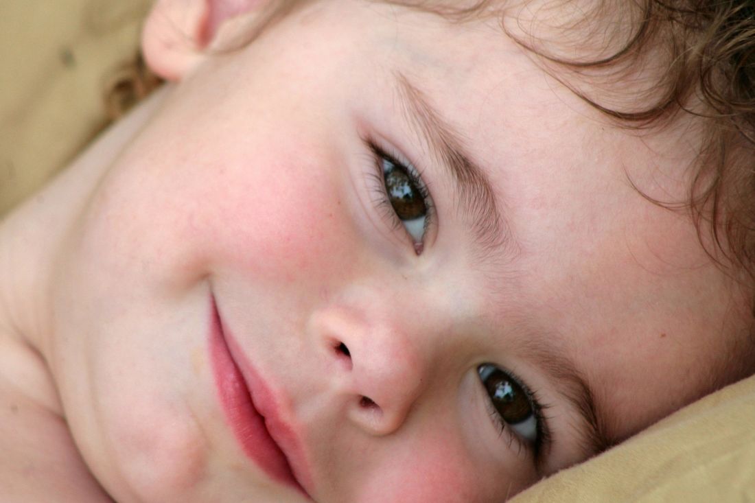 image 4 Penyebab Ruam Merah Pada Kulit Bayi Setelah Demam