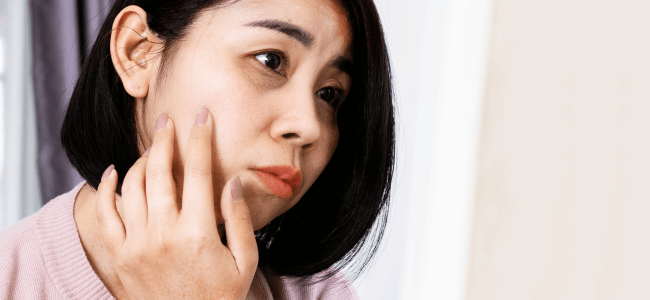 image 5 Cara Menghilangkan Mata Panda yang Aman dan Efektif