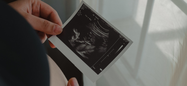 image 5 Ciri-Ciri Janin Tidak Berkembang di Rahim dan Penyebabnya