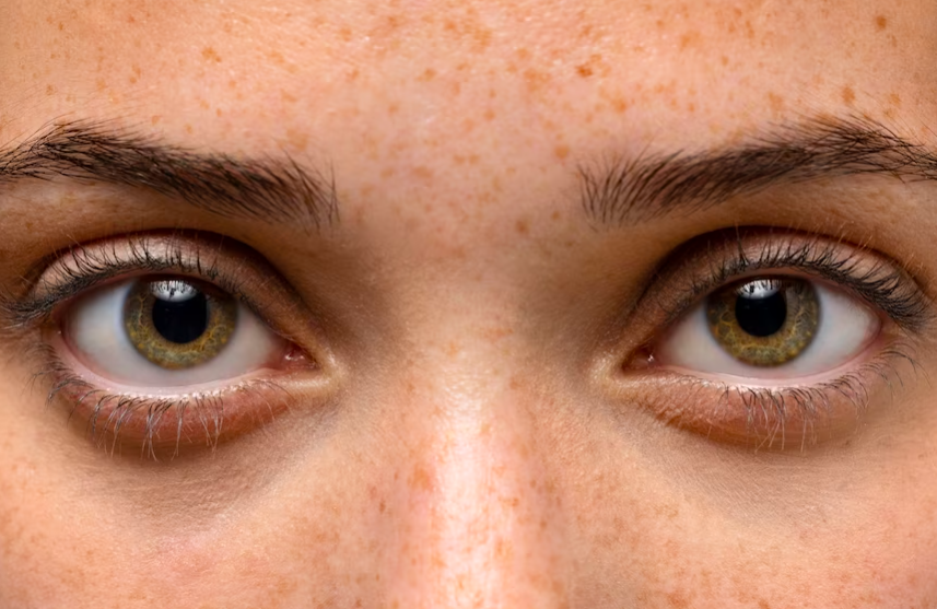 image 6 Cara Menghilangkan Flek Hitam di Wajah secara Alami