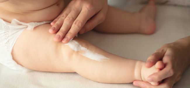 image 7 Rekomendasi Pelembab Untuk Kulit Kering Pada Bayi Terbaik!