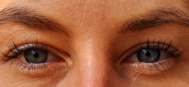 image 8 Cara Mengatasi Mata Lelah dan Gejala Umumnya