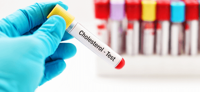 image 9 Ciri Ciri Kolesterol Tinggi dan Penyebabnya