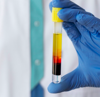 image Apa Itu HBsAg dan Bagaimana Penerapannya Dalam Dunia Medis?