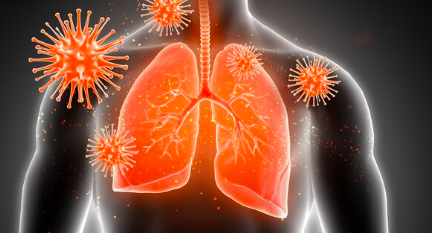 image Apa Itu TBC? Inilah Gejala Dan Cara Menanganinya