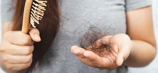 image Atasi Rambut Rontok dengan Biotin, Berapa Dosis Idealnya?