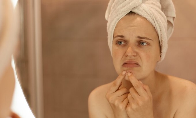 image Bagaimana Cara Menghilangkan Bruntusan di Pipi Secara Alami dan Tanpa Efek Samping?