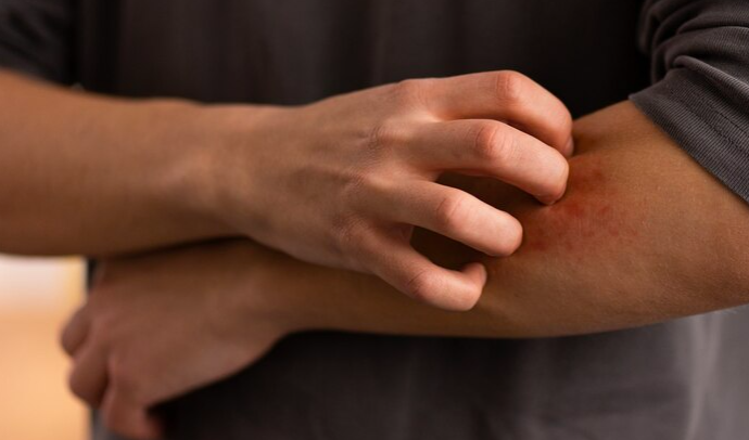 image Cara Menghilangkan Bekas Luka yang Menghitam Secara Permanen dan Aman