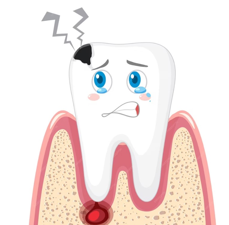 image Cara Menghilangkan Sakit Gigi Yang Berlubang dengan Tepat