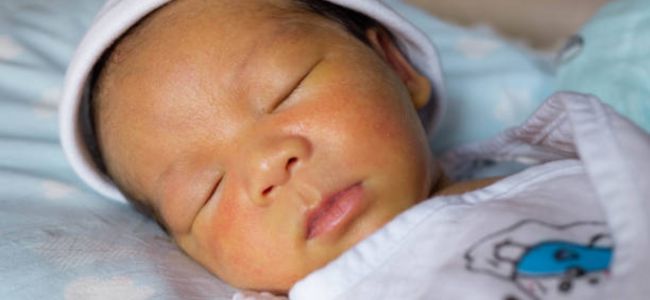 image Ciri-Ciri Bayi Kuning karena ASI, Penyebab & Cara Mengatasinya!