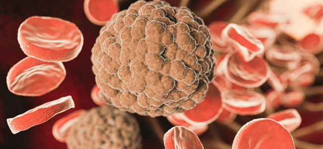 image Hindari Ini, 10 Daftar Pantangan Kolesterol yang Berbahaya!