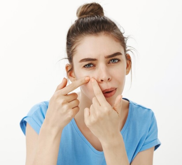 image Inilah Cara Menghilangkan Bruntusan Dengan Cepat, Kembalikan Kepercayaan Diri!