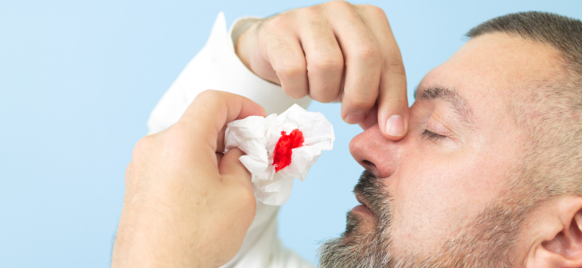 image Kenali 5 Penyebab Sering Mimisan dan Cara Mencegahnya