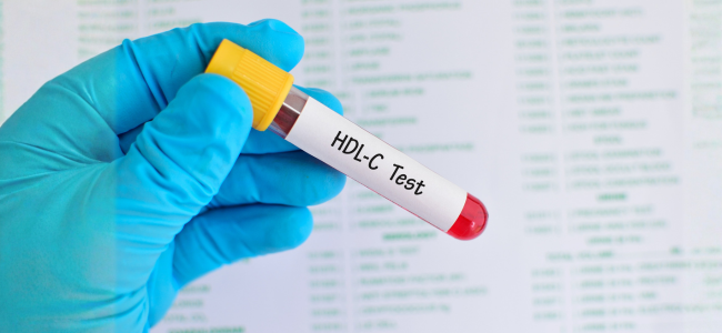 image Kolesterol HDL, Jenis Kolesterol yang Baik untuk Kesehatan Jantung