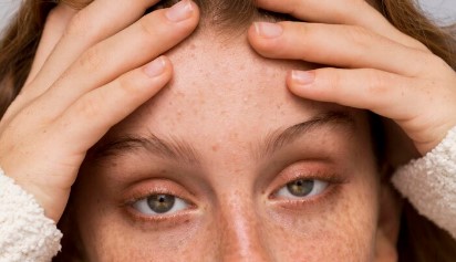 image 8 Cara Menghilangkan Jerawat di Jidat Beserta Penyebabnya!