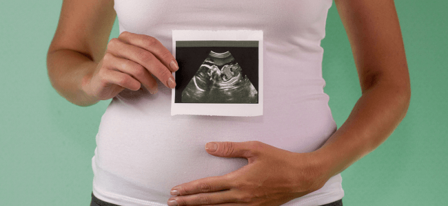 image Rekomendasi Vitamin Ibu Hamil Trimester 1 yang Bagus dan Aman!