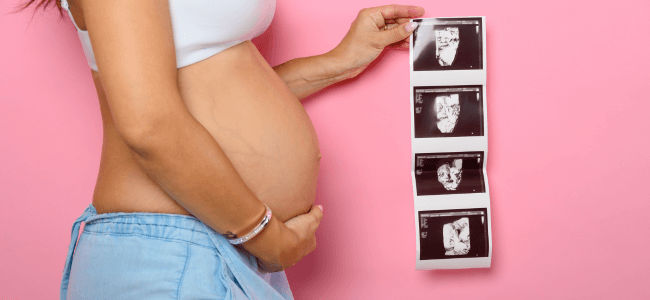 image Rekomendasi Vitamin untuk Ibu Hamil dan Pertumbuhan Janin