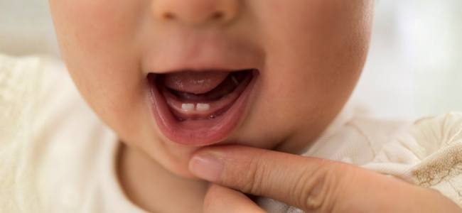 image Tahapan Pertumbuhan Gigi Bayi, Ortu Wajib Tahu!