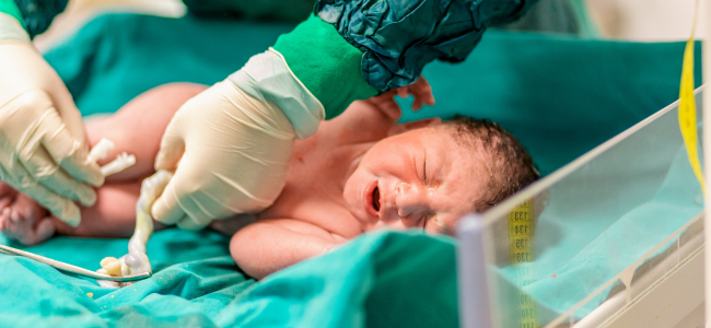 image Tutorial Cara Merawat Tali Pusat Bayi Baru Lahir yang Aman